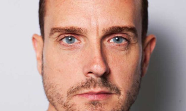 BOTOX For Men – Tried & Tested