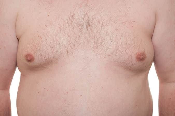 Cosmetic Surgery Trends – Botox, Sweating &  Male Breast Reduction