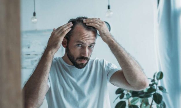 Facing Sudden Hair Loss? You Might Have a Hair Disorder